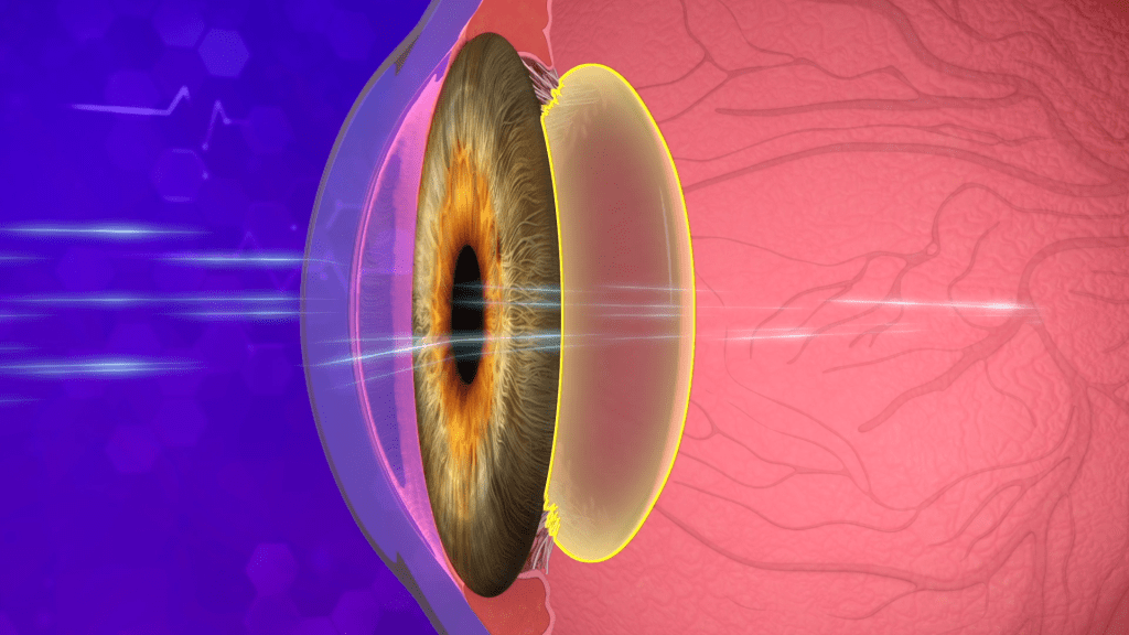 How Do Eyes Work? 1 Illustration of the human eye showing the pupil, lens, and retina, with light rays entering the eye.